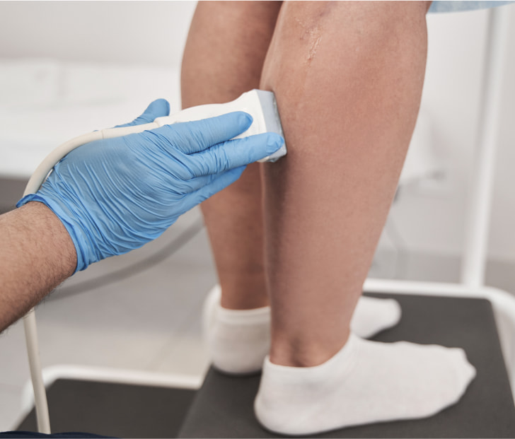 a photo of a technician administering vascular ultrasound to the calf of a patient