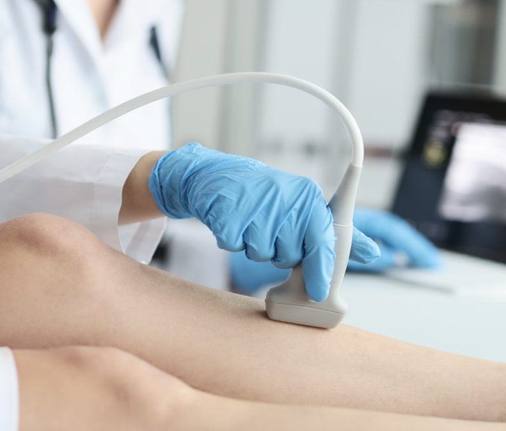 a photo of a technician administering vascular ultrasound to the lower leg of a patient