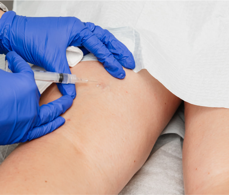 a photo of a technician treating varicose veins